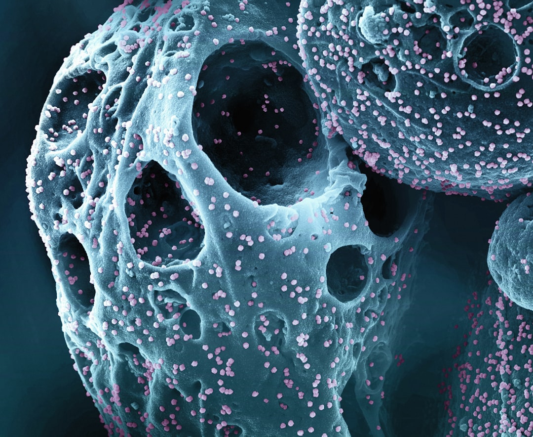 découvrez tout sur la nécrose, un phénomène de mort cellulaire affectant les tissus vivants, ses causes, symptômes et traitements.