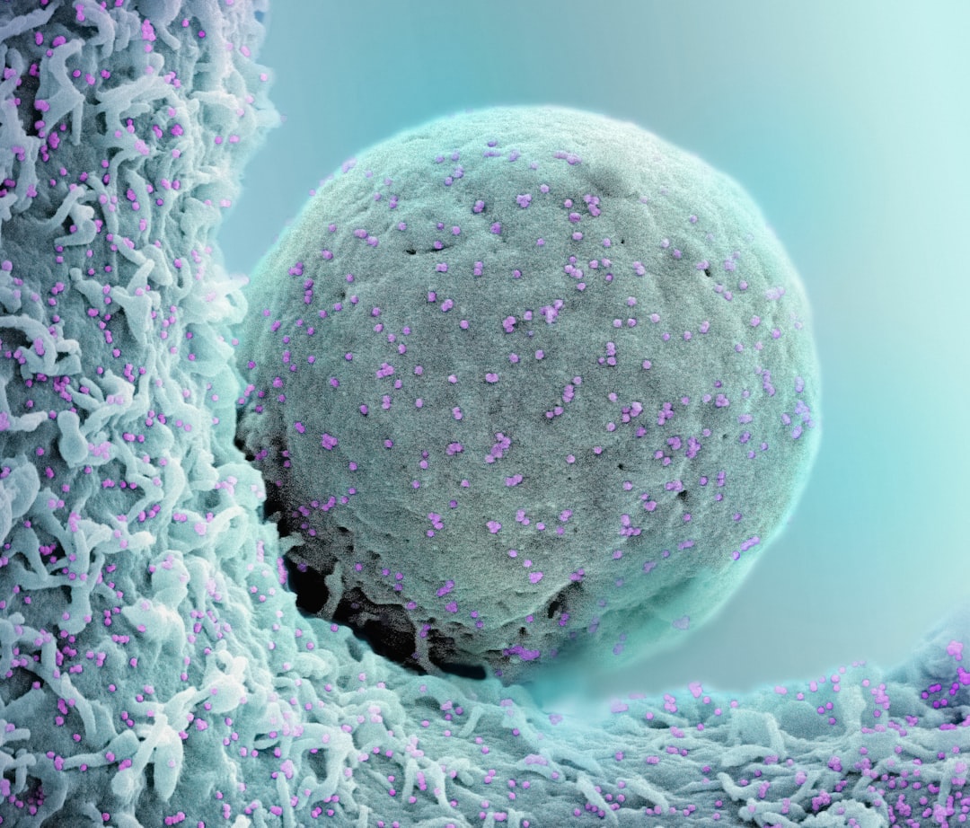 la nécrose désigne la mort prématurée des cellules ou des tissus dans l'organisme, souvent provoquée par une infection, un traumatisme ou un manque d'oxygène. découvrez ses causes, symptômes et traitements.
